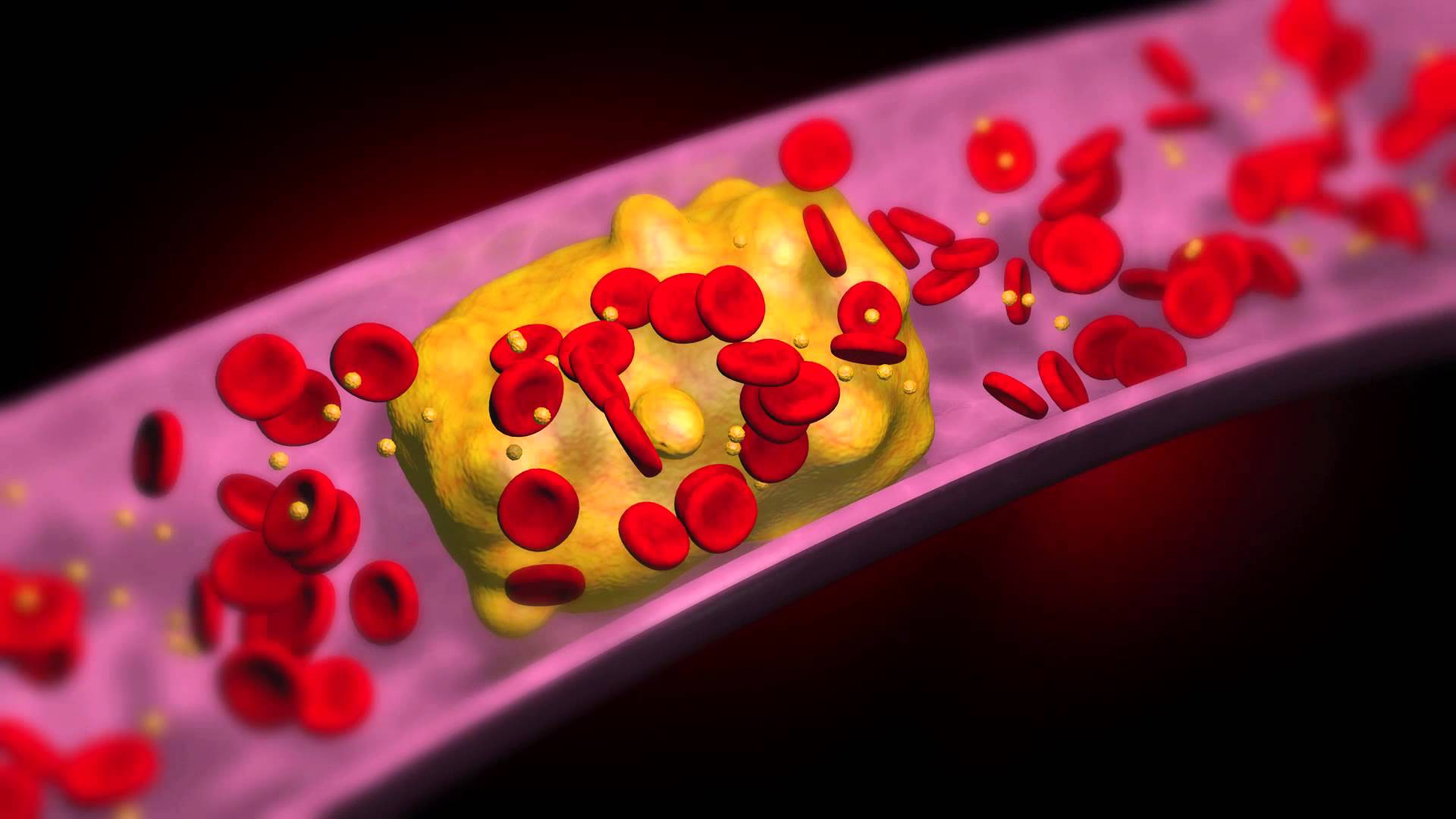 Cholesterol. Холестерин. Холестерин в крови. Липиды в крови. Холестерин картинки.