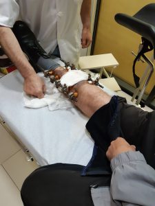 სიკვდილს გადაურჩა, მაგრამ შრომისუუნარო გახდა და სამსახურში არავის აყავს, სახელმწიფოს მიერ დანიშნულ 30 ლარს კი ბანკი აჭრის - საბედისწერო ავარია, რომელმაც ალექსანდრე ხანიაშვილის ცხოვრება შეცვალა